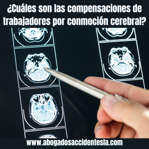 compensación-conmoción-cerebral